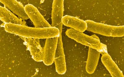 Salmonella - a needle in a haystack?