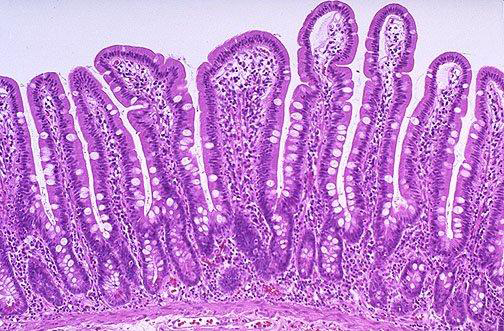 The intestine: an overlooked aspect of mycotoxin challenge