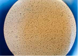 Training bacteria to convert bio-wastes into plastic